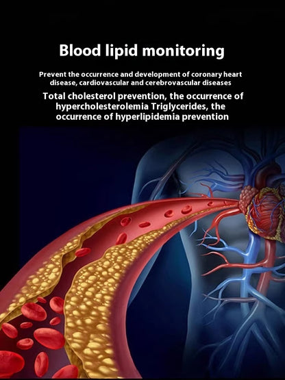 ECG Blood Pressure Heart Rate Smart Watch - HYPERMALL